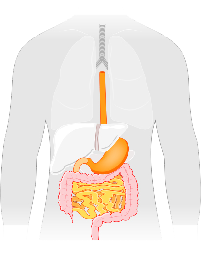 Short Bowel Syndrome